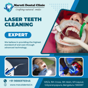 laser teeth cleaning