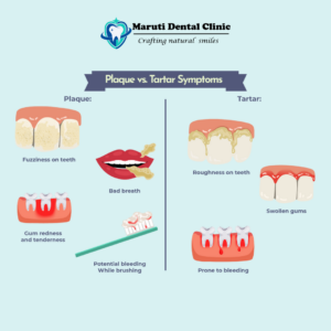 Plaque in Teeth