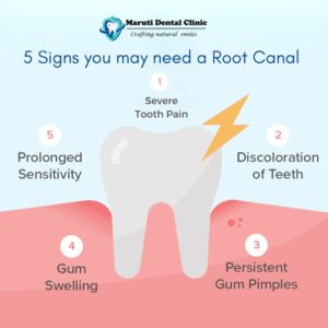 5 sign you may need root canal