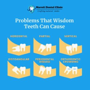 wisdom teeth pain relief