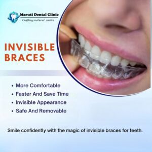 Invisible Braces