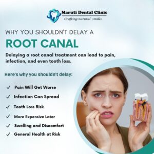 Root Canal