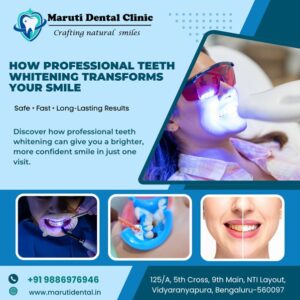 professional teeth whitening