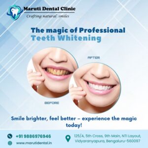 Magic of professional teeth whitening