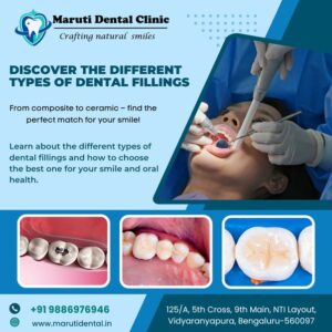 types of dental fillings 