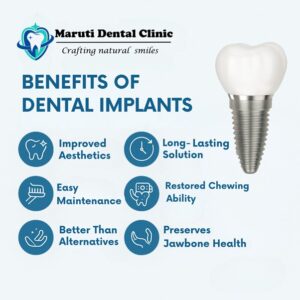 benefit of dental implant