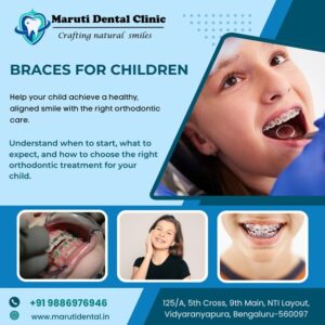 Braces for children