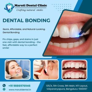 Dental Bonding