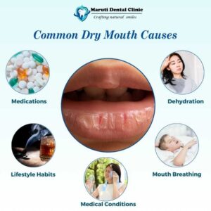 dry mouth causes