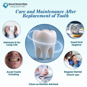 Care & maintenance after tooth replacement