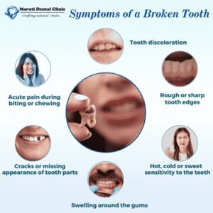 Symptom of broken tooth