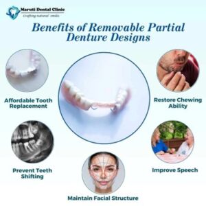 Benefits of removable partial denture design