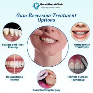 Gum recession treatment