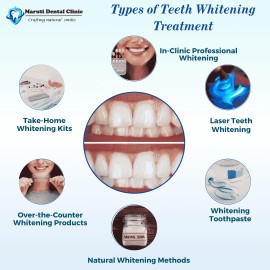 Types of Teeth whitening treatment