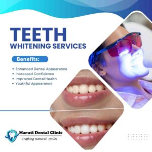 teeth whitening