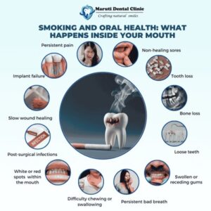 Smoking and oral health: what happend inside your mouth