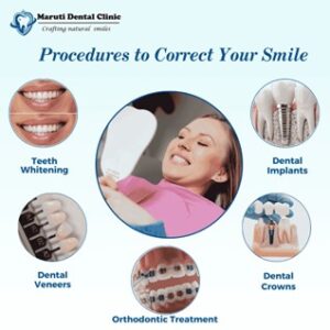 procedure to correct your smile