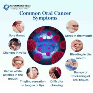 oral cancer symptoms