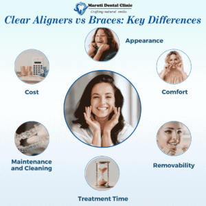 clear aligners vs braces