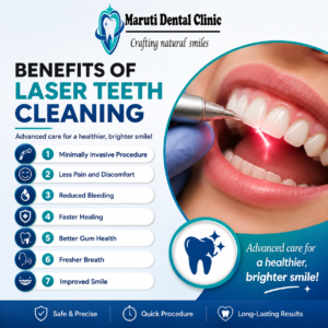 laser teeth cleaning