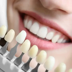 Cosmetic-Dentistry