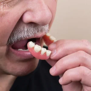 Removable Complete Denture