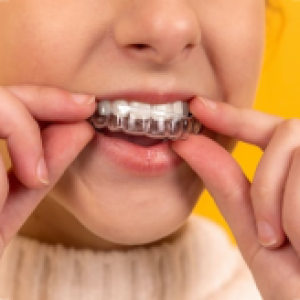 aligners