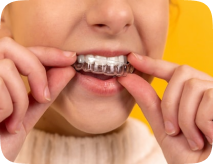 aligners aligners
