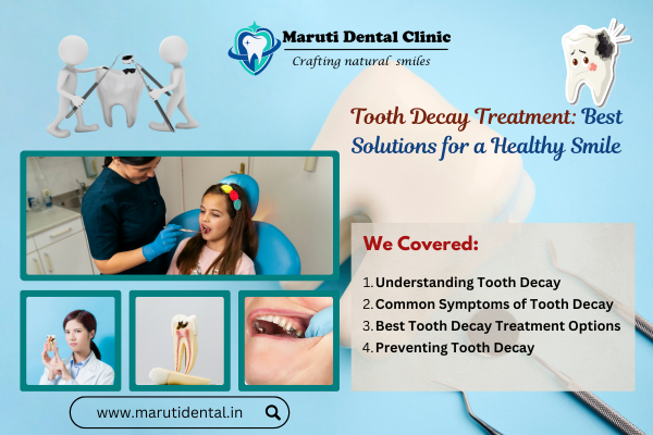 Tooth Decay Treatment: Best Solutions for a Healthy Smile