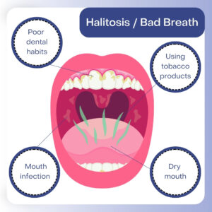 Bad Breath Home Treatments
