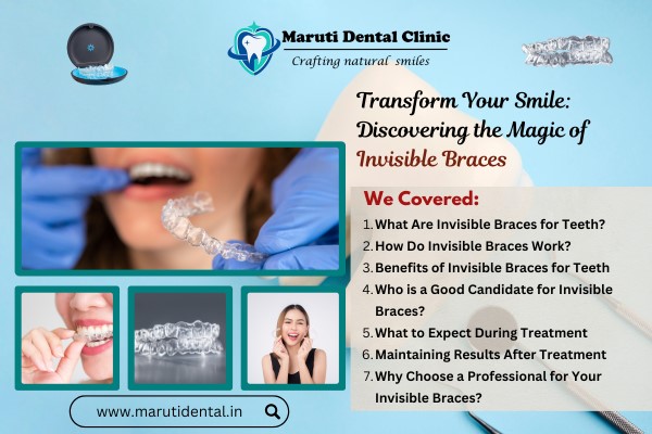 Make Your Smile: Discovering the Magic of Invisible Braces