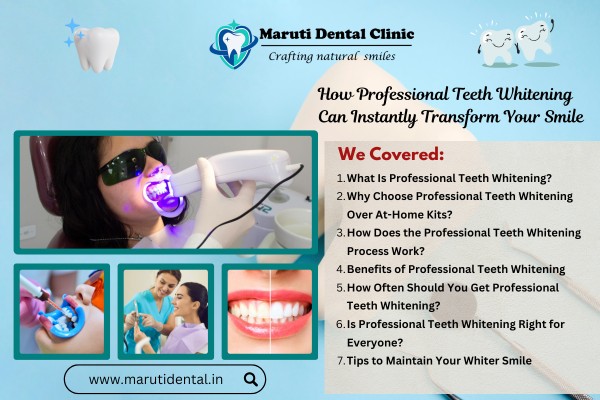 How Professional Teeth Whitening Can Instantly Transform Your Smile