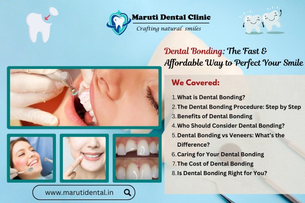 Dental Bonding: Fast & Affordable Smile Perfection