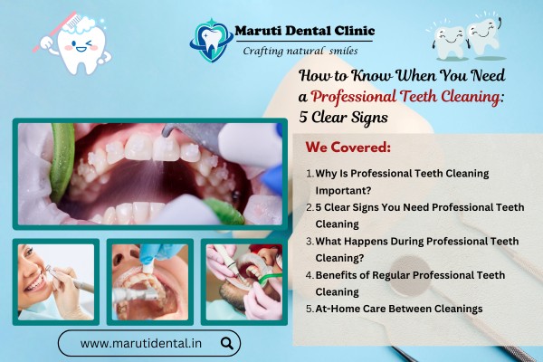 How to Know When You Need a Professional Teeth Cleaning