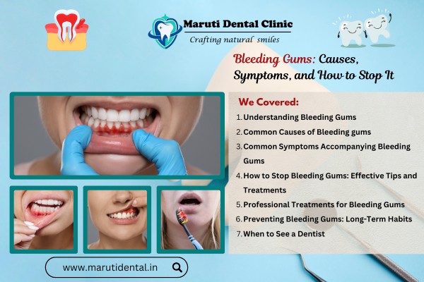 Bleeding Gums: Causes, Symptoms, and How to Stop It