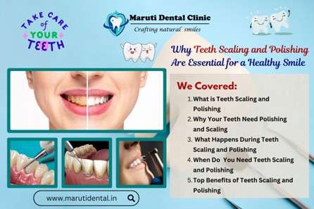 Why Teeth Scaling and Polishing Are Essential for a Healthy Smile