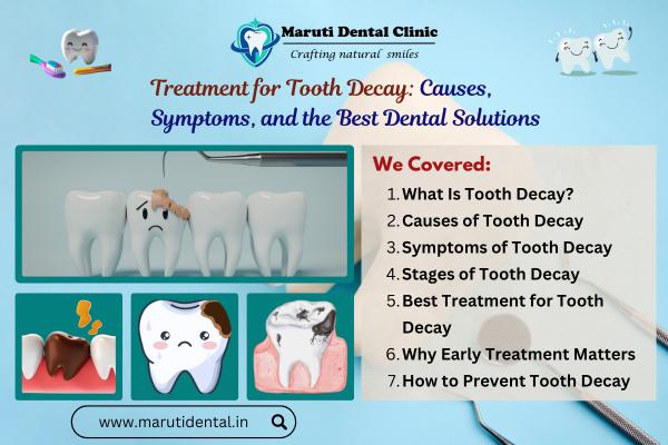 Treatment for Tooth Decay: Causes, Symptoms, and the Best Dental Solutions