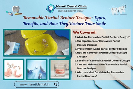 Removable Partial Denture Designs: Types, Benefits, and How They Restore Your Smile