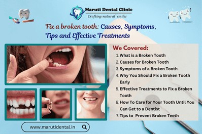 How to Fix a Broken tooth: Causes, Symptoms, Tips and Effective Treatments