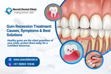 Gum Recession Treatment: Causes, Symptoms & Best Solutions