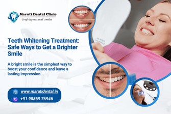 Teeth Whitening Treatment: Safe Ways to Get a Brighter  Smile