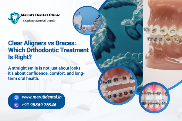 Clear Aligners vs Braces: Which Orthodontic Treatment Is Right?