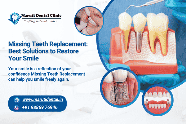 Missing Teeth Replacement: Best Solutions to Restore Your Smile