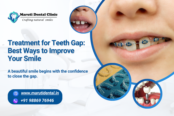treatment for teeth gap