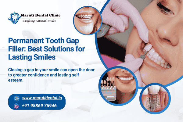 permanent tooth gap filler